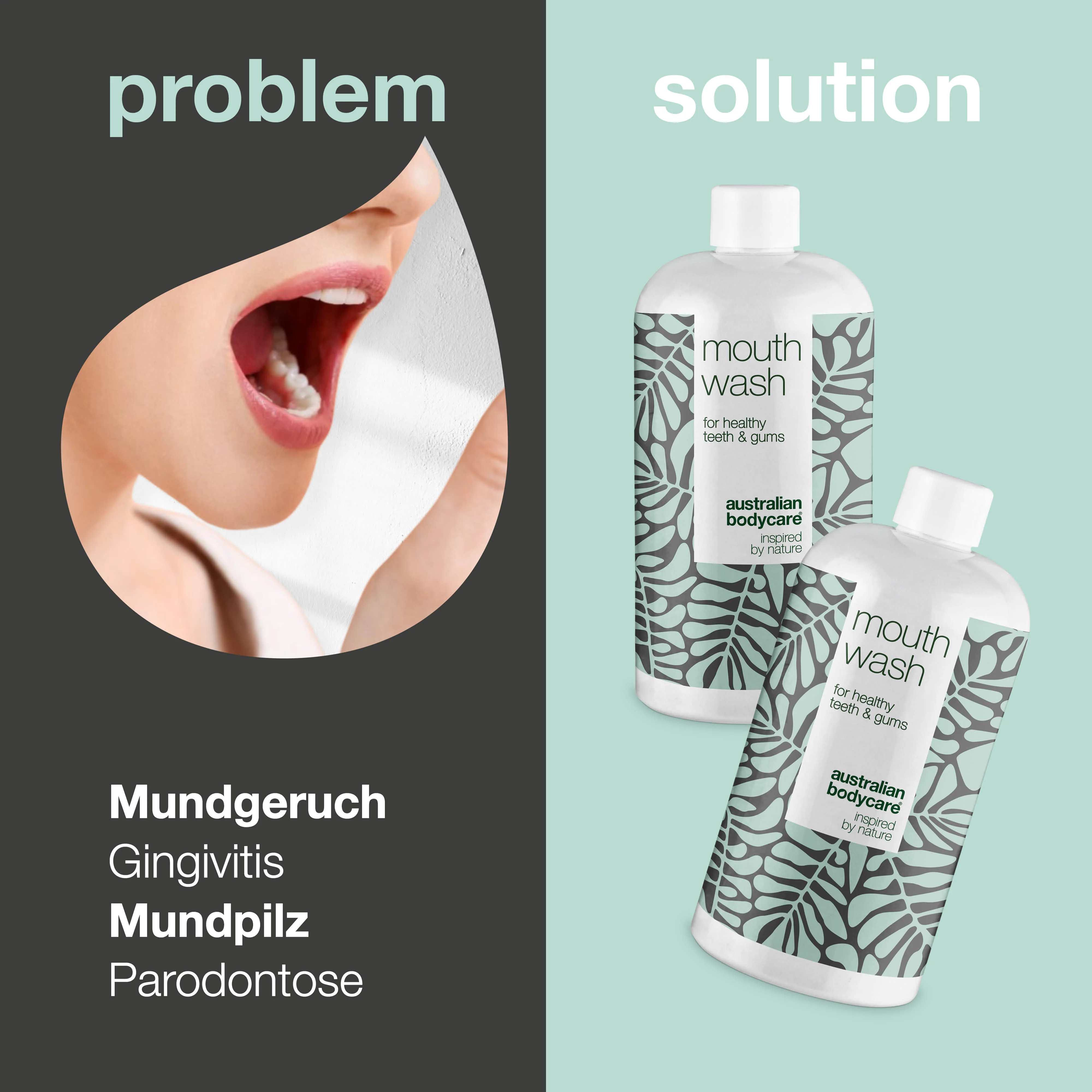 2 Mundspülungen gegen Mundgeruch, Parodontitis & Gingivitis — Für die tägliche Pflege bei Pilz und Zahnfleischentzündung - Image 2