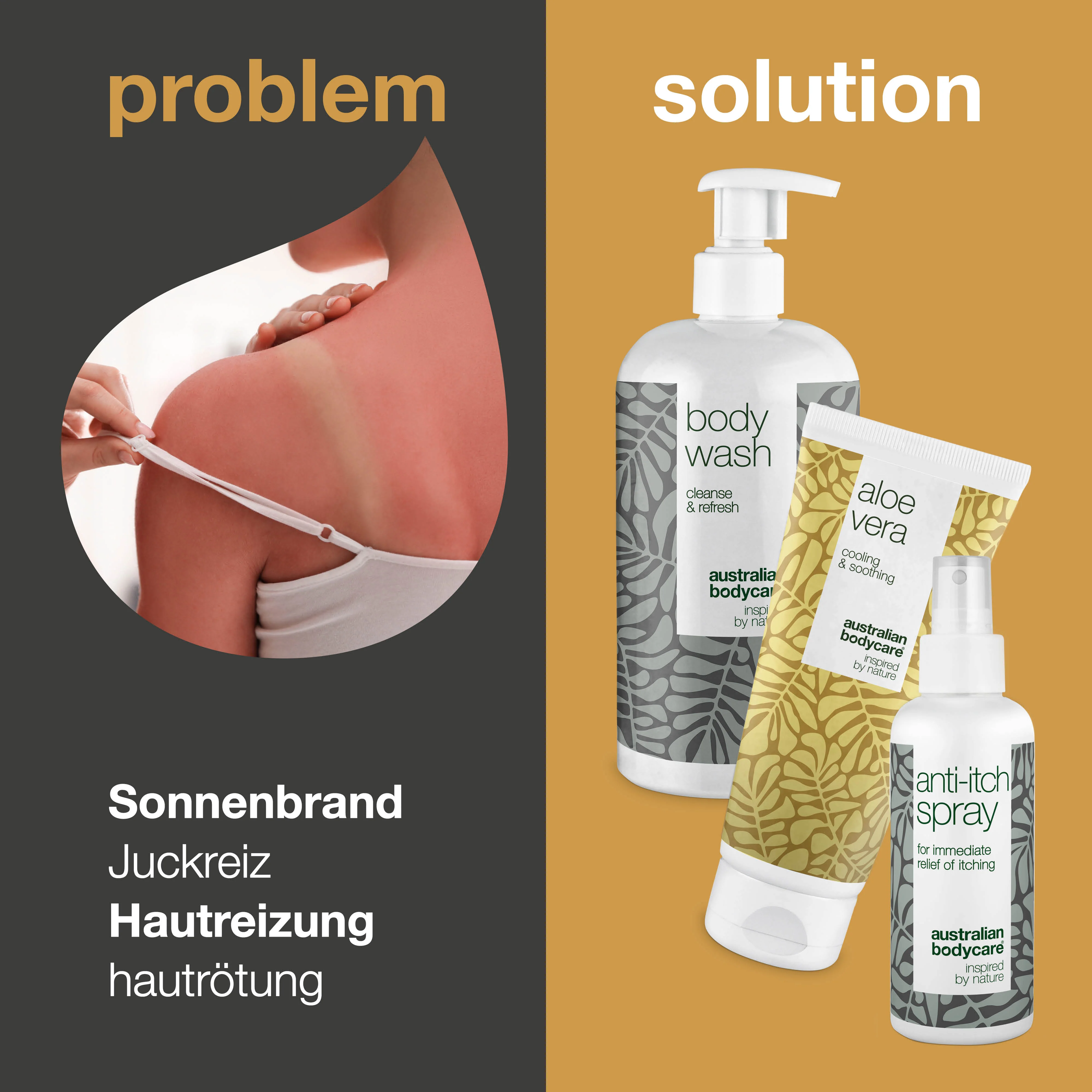 After Sun Paket für gerötete Haut und Sonnenbrand — 3 Produkte zur Pflege von Sonnenbrand, brennender Haut und bei Sonnenallergie - Image 2
