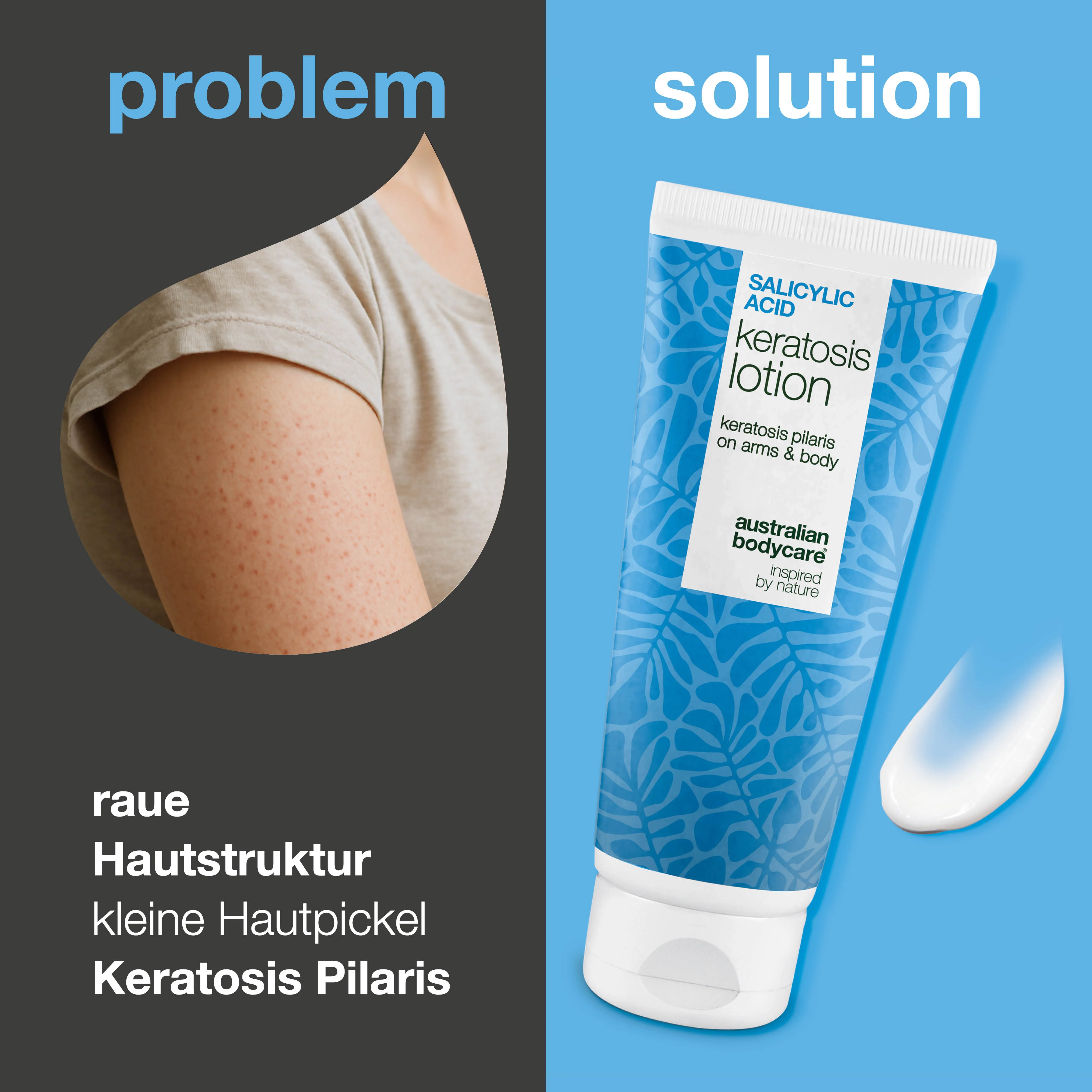 Körperlotion bei Keratosis Pilaris & Reibeisenhaut — Body lotion gegen Keratosis Pilaris. Glättet mit Salicylsäure, Niacinamid und Zink. Für raue, trockene Haut. - Image 2