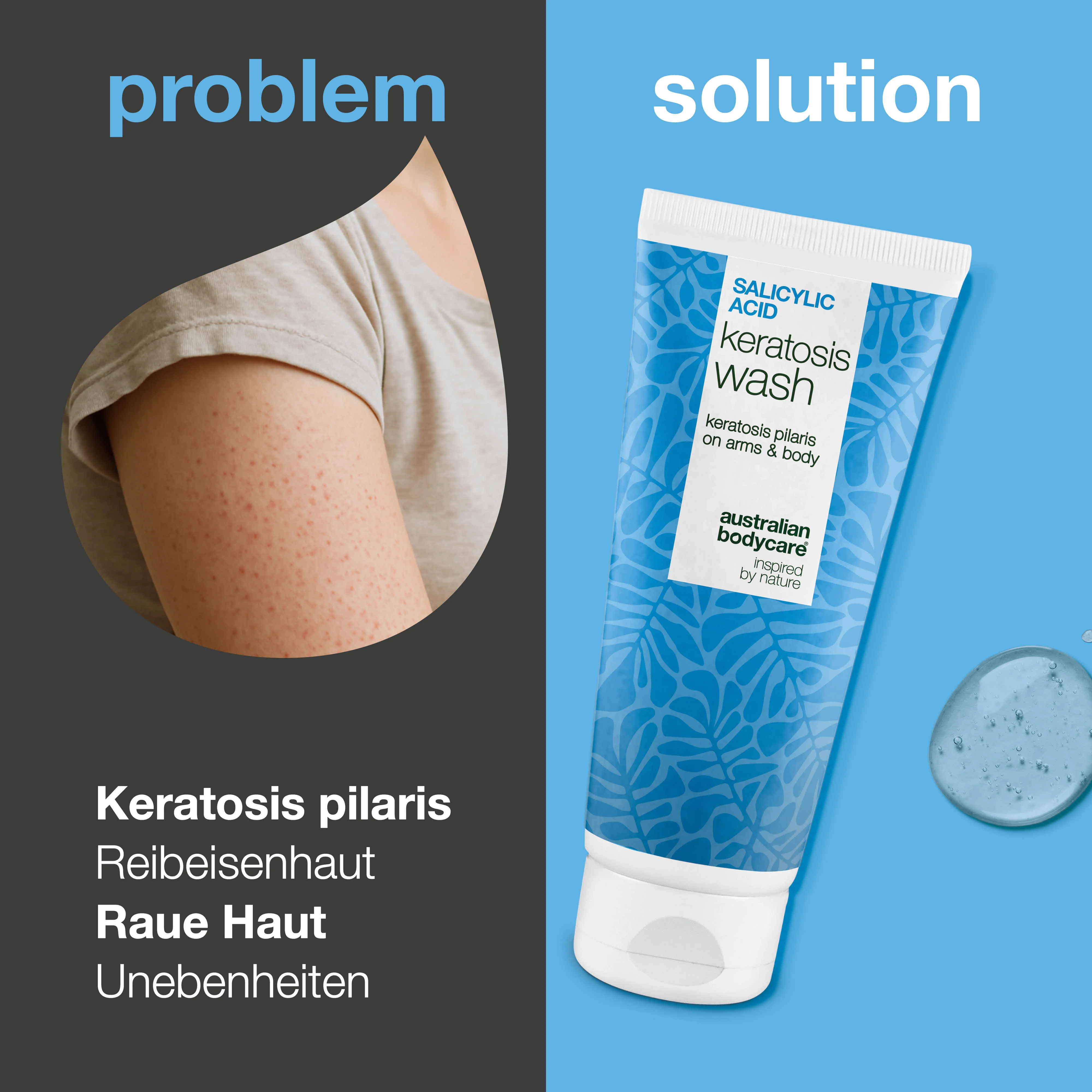 Keratosis Pilaris Duschgel – gegen Reibeisenhaut und Knötchen — Keratosis Pilaris Duschgel gegen Reibeisenhaut. Mit Salicylsäure, Niacinamid und Glycerin für glatte, hydratisierte Haut. - Image 2