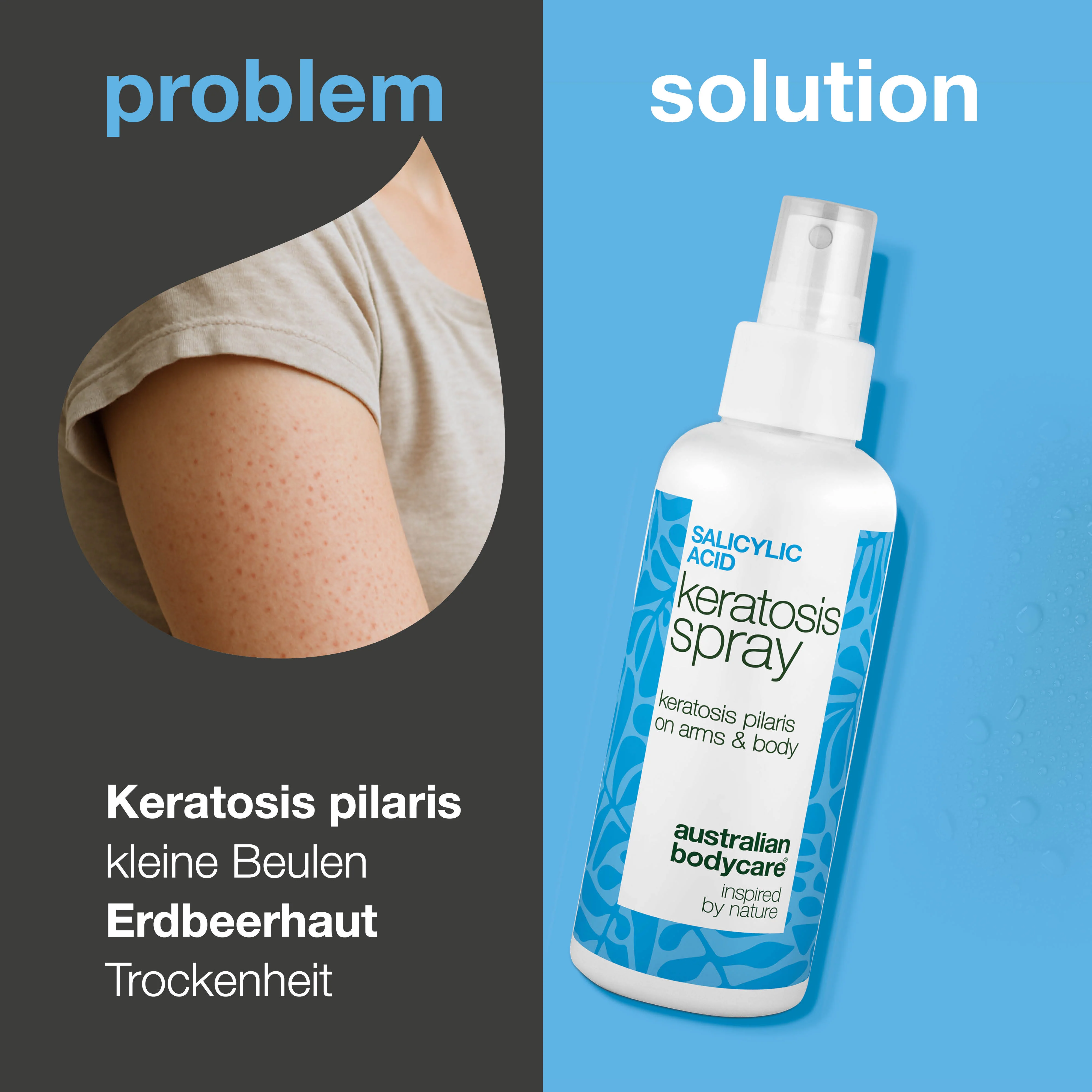 Spray bei Keratosis Pilaris und Reibeisenhaut an Armen und Beinen — Keratosis Pilaris Spray glättet raue Haut und Pickelchen. Mit Salicylsäure zur sanften, tiefenwirksamen Exfoliation. - Image 2
