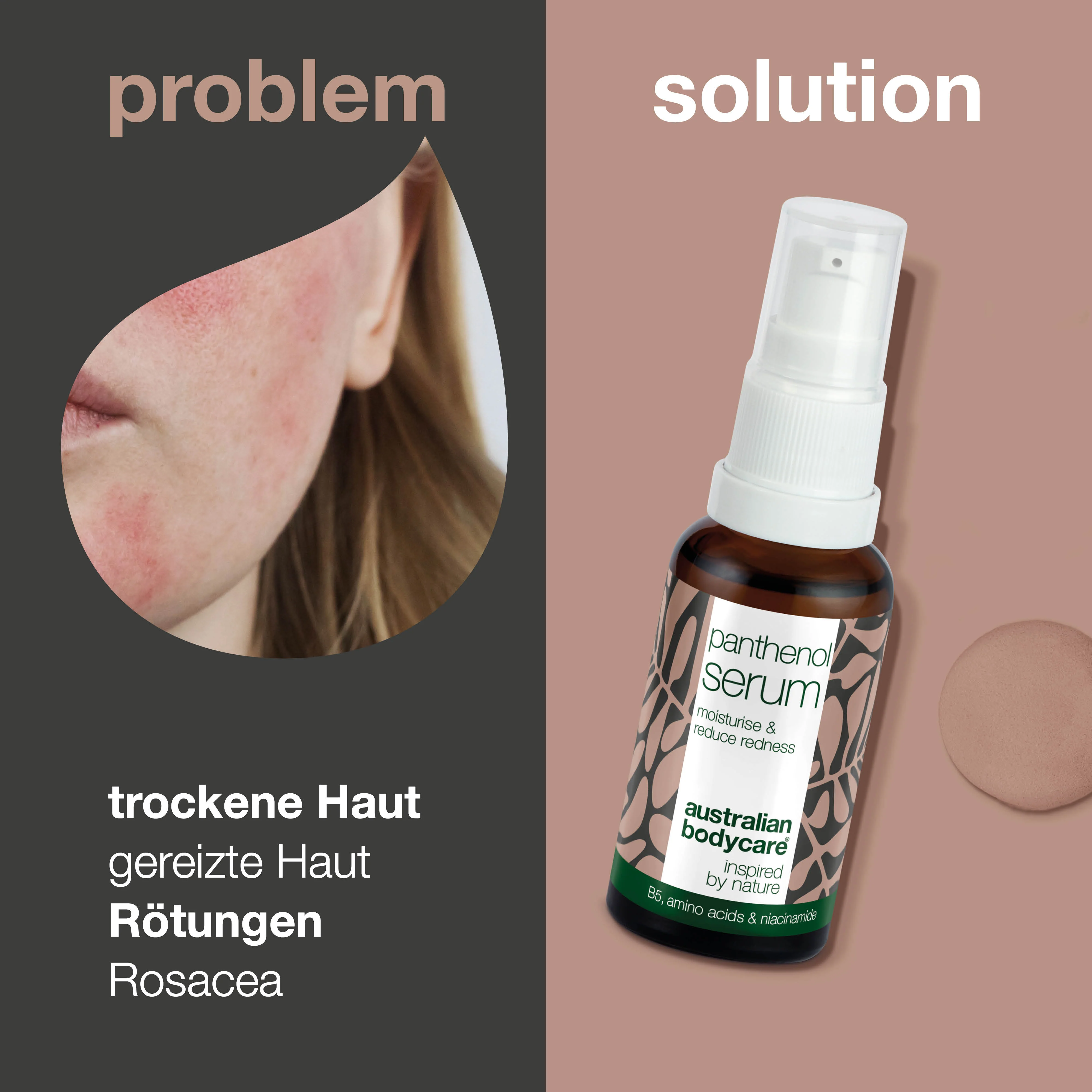 Panthenol Serum – Beruhigende Pflege für Rötungen & Rosacea — Panthenol Serum hydratisiert & beruhigt Rötungen, Rosacea & trockene Haut. Stärkt die Hautbarriere & reduziert Irritationen. - Image 2