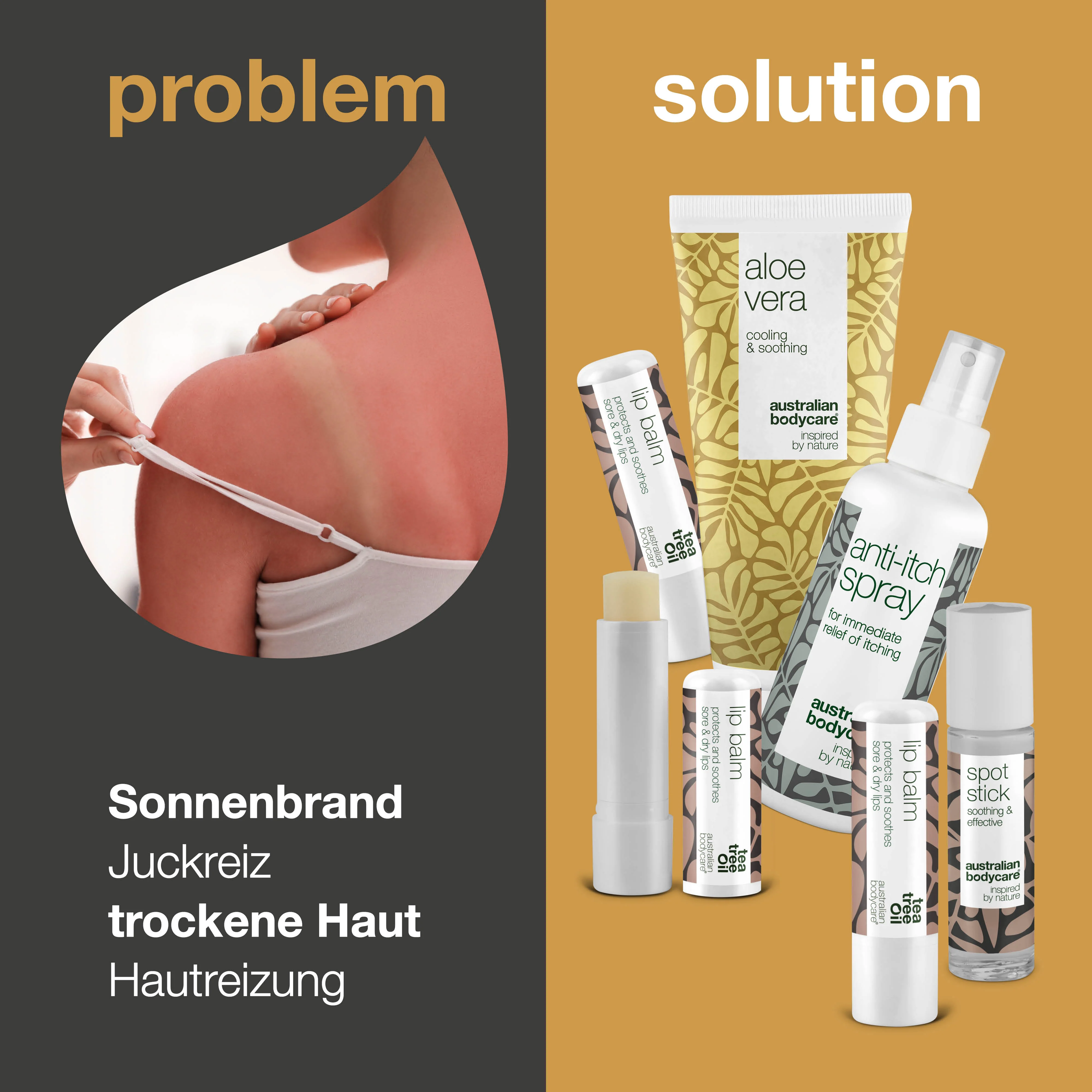 Sommerprodukte — Produkte zur Pflege bei Sonnenbrand oder anderen Hautproblemen - Image 2