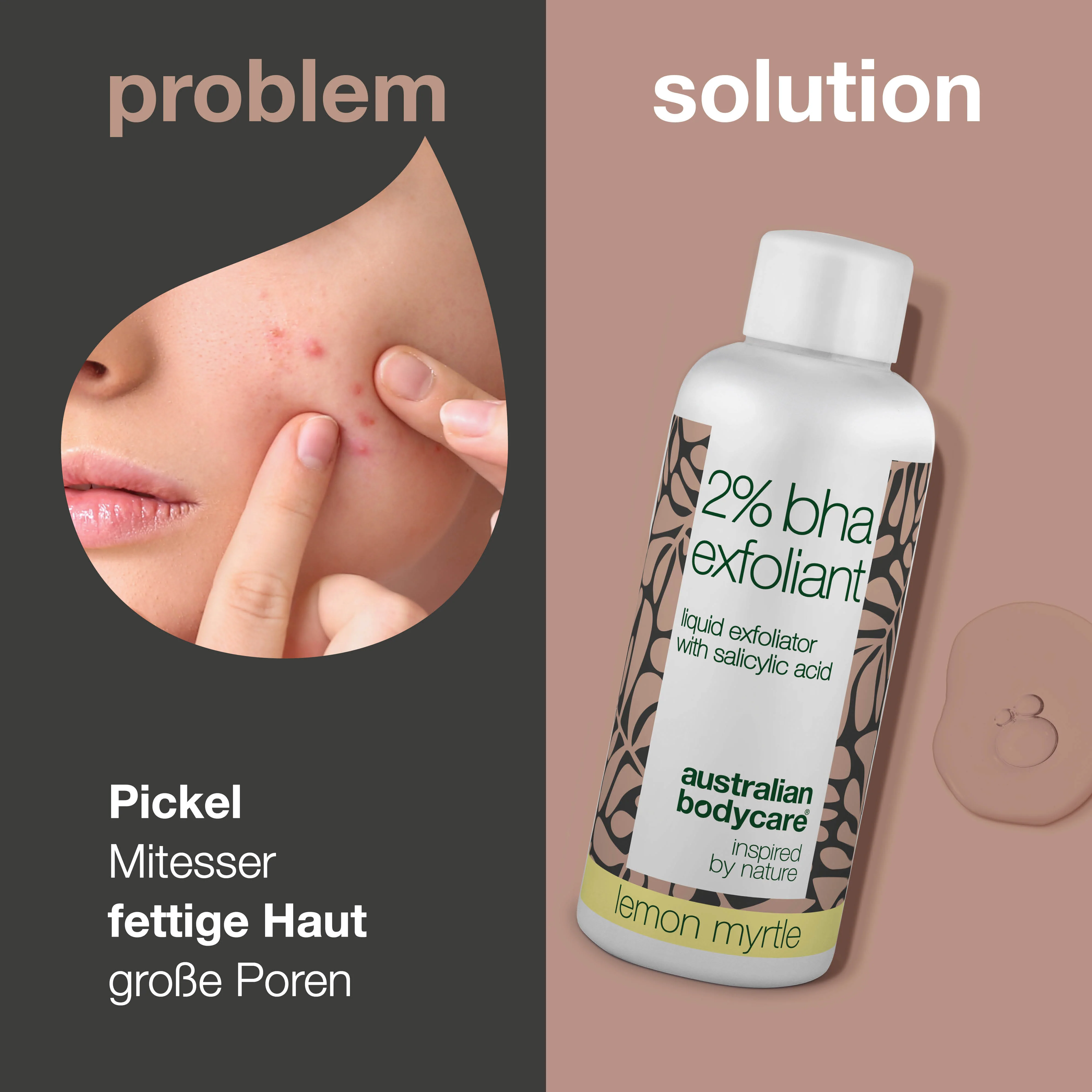 T-zone Peeling 2% BHA – Reinigt Poren & reduziert Mitesser — T-zone Peeling 2% BHA entfernt abgestorbene Hautzellen, reguliert Talg und hilft bei Pickeln. Für eine reinere und glattere Haut. - Image 2