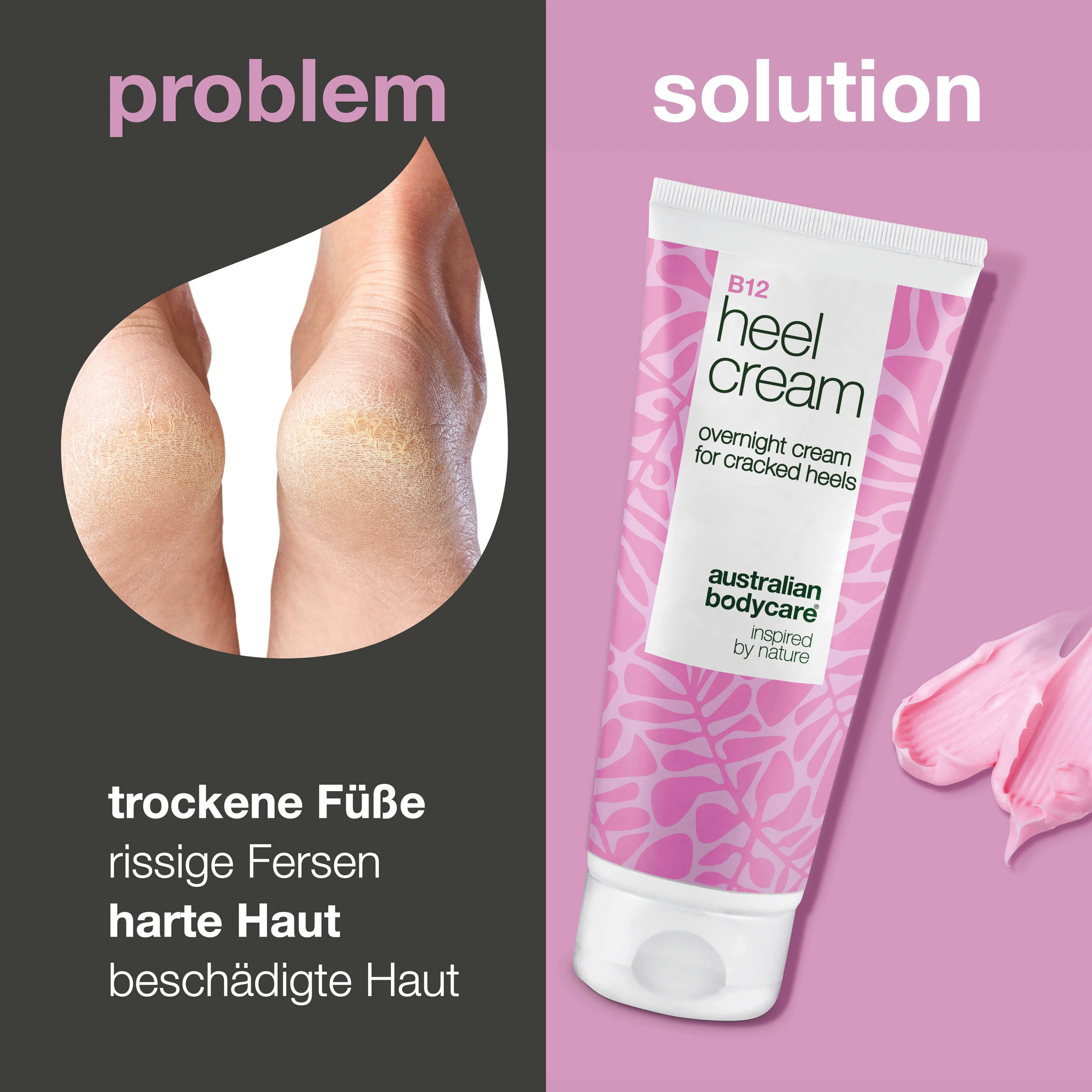 Intensive Fersenpflege mit 25 % Urea & Vitamin B12 — Sag trockenen Fersen ade! Diese Creme mit 25 % Urea & Vitamin B12 versorgt die Haut intensiv mit Feuchtigkeit und Pflege. - Image 2