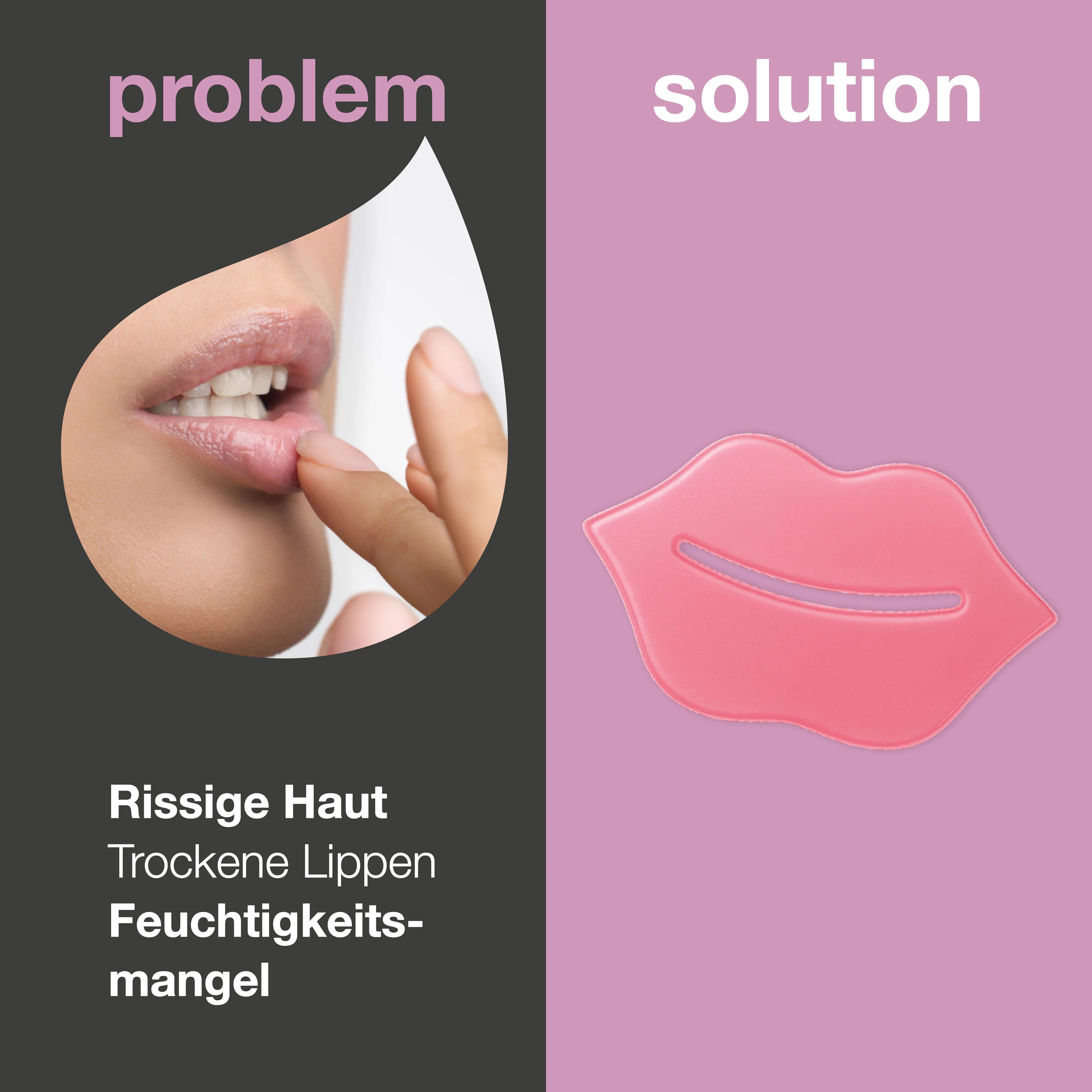 Lippenmaske bei trockenen Lippen und Fältchen – mit B12 — Lippenmaske bei trockenen, rissigen Lippen. Pflegt mit B12, Kollagen und Hyaluronsäure. Glättet und spendet Feuchtigkeit. - Image 2